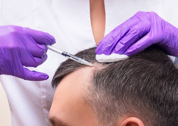 advanced-hair-prp-therapy-treatment-in-delhi