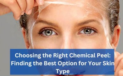 Choosing the Right Chemical Peel: Finding the Best Option for Your Skin Type