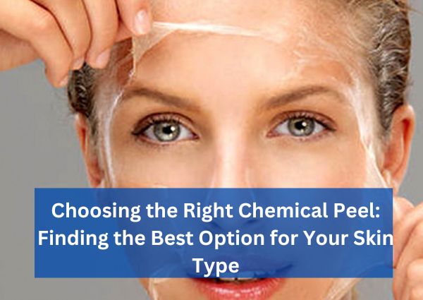 Choosing the Right Chemical Peel: Finding the Best Option for Your Skin Type