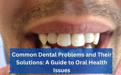  Common Dental Problems and Their Solutions: A Guide to Oral Health Issues