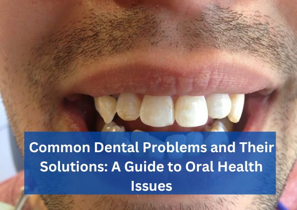  Common Dental Problems and Their Solutions: A Guide to Oral Health Issues
