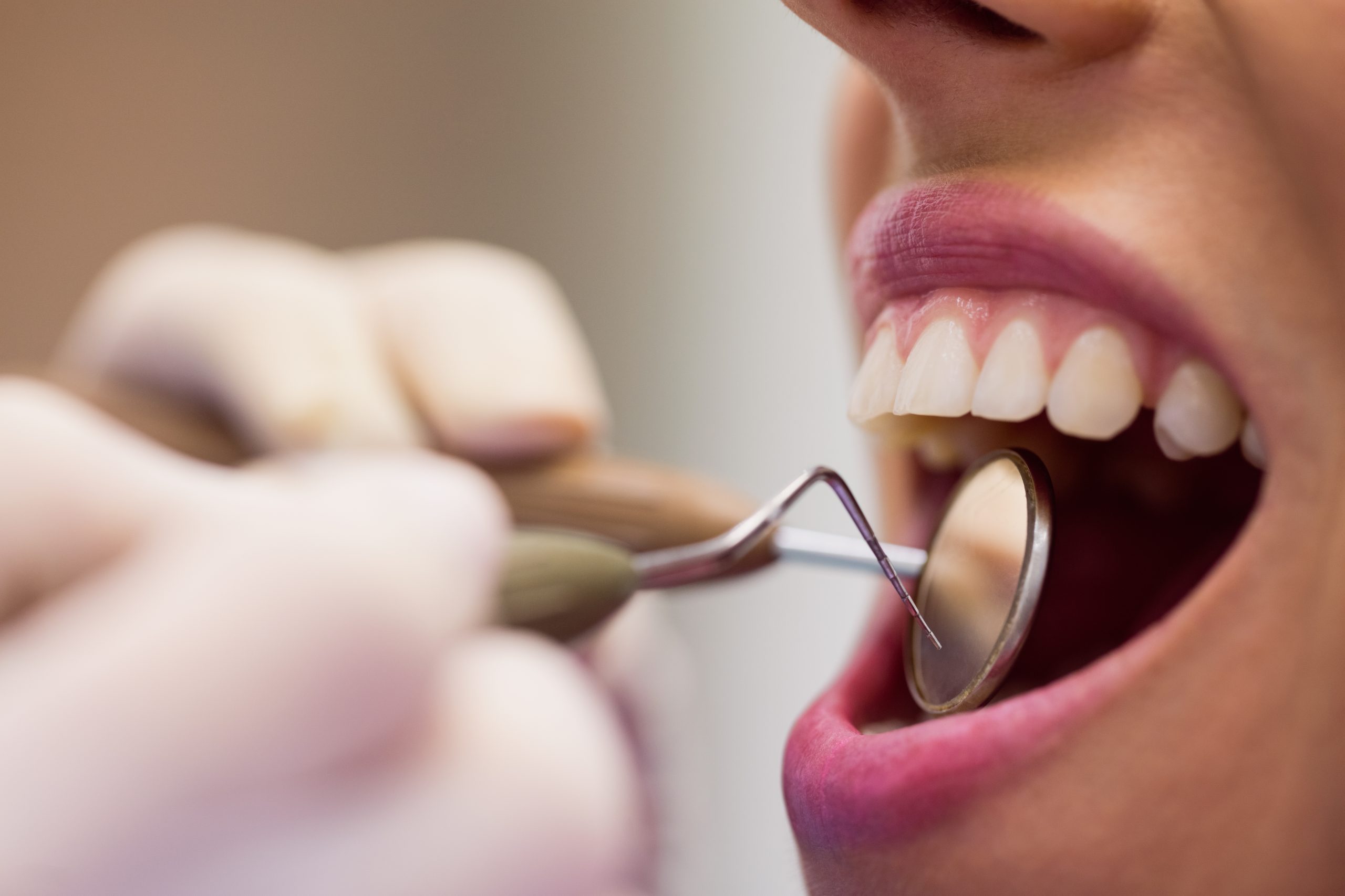Dental-implant-clinic-delhi-india