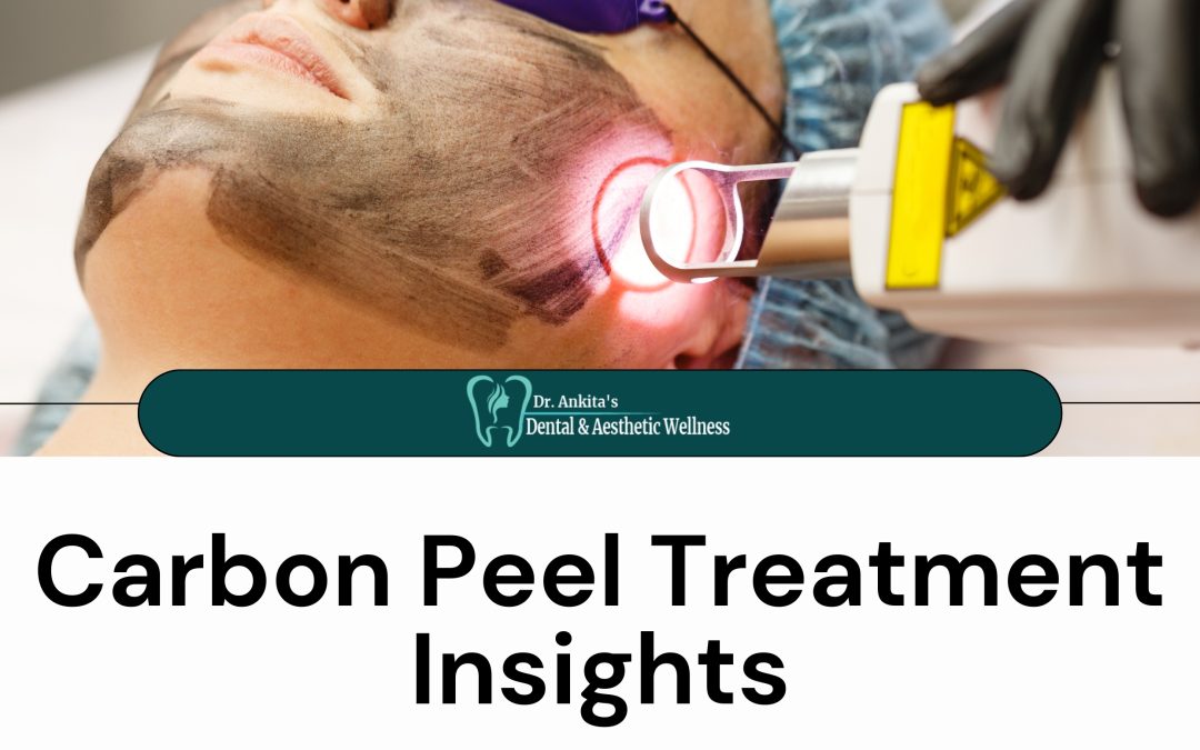 10 Crucial Insights into Carbon Peel Treatment