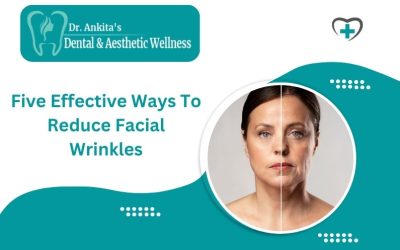 How To Reduce Wrinkles on Face? 5 Ways To Get Rid Of