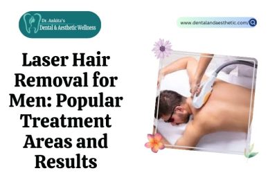 Laser Hair Removal for Men: Popular Treatment Areas and Results