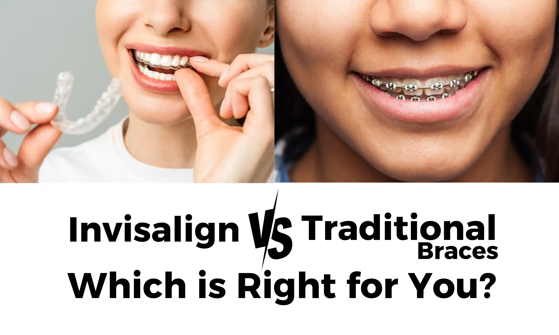 Invisalign vs. Traditional Braces Dental And Aesthetic