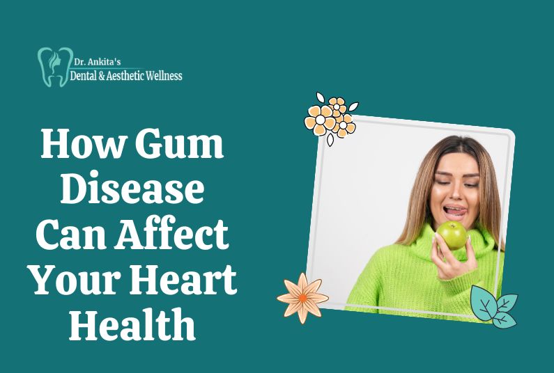 How Gum Disease Can Affect Your Heart Health: Understanding The Connection