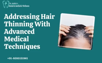 Addressing Hair Thinning With Advanced Medical Techniques