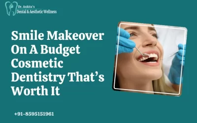 Smile Makeover On A Budget: Cosmetic Dentistry That’s Worth It