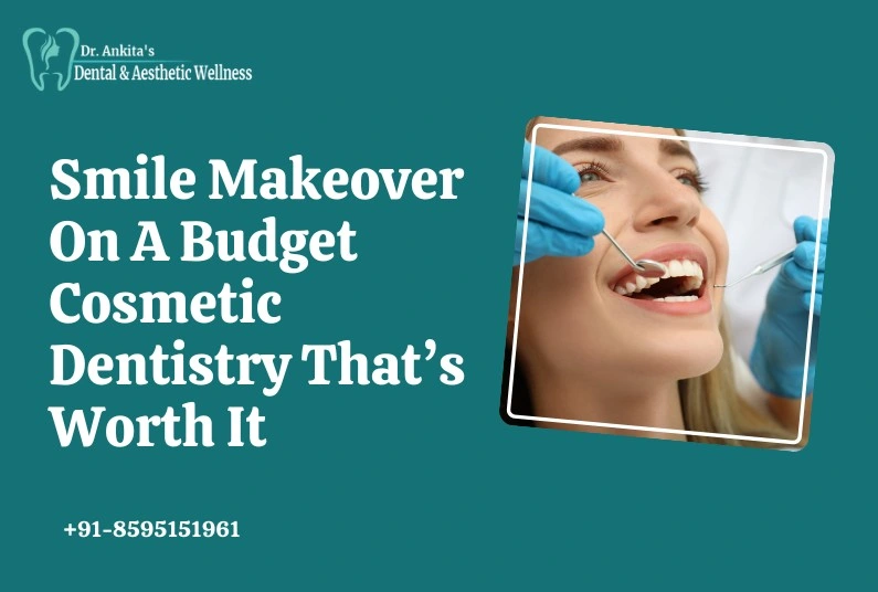 Smile Makeover On A Budget: Cosmetic Dentistry That’s Worth It