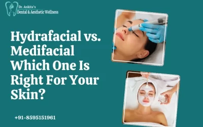 Hydrafacial vs. Medifacial: Which One Is Right For Your Skin?