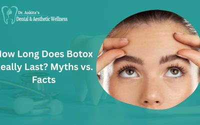 How Long Does Botox Really Last? Myths vs. Facts