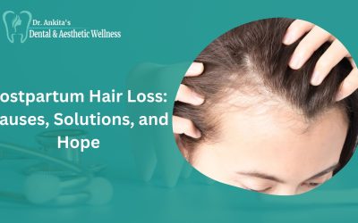 Postpartum Hair Loss: Causes, Solutions, and Hope