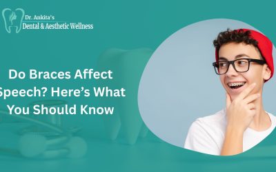 Do Braces Affect Speech? Here’s What You Should Know