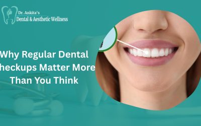 Why Regular Dental Checkups Matter More Than You Think